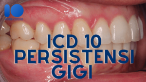 ICD 10 Persistensi Gigi